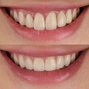 Prosthodontics